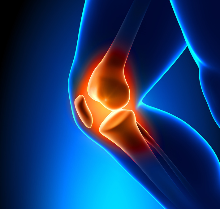 Knee Pain