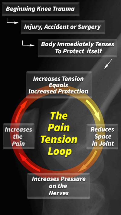 knee pain tension loop