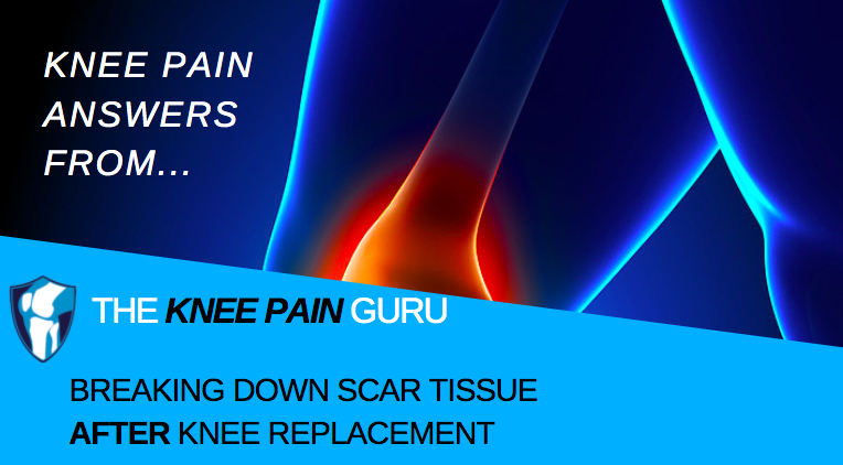 Scar Tissue AFTER Knee Replacement