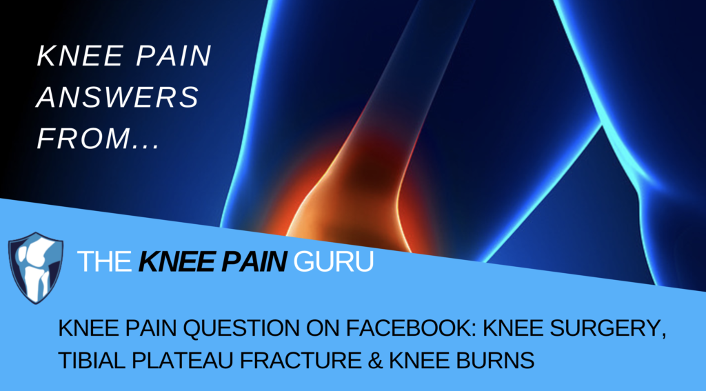 Knee Pain Facebook: Knee Surgery, & Tibial Plateau Fracture
